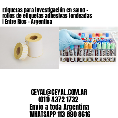 Etiquetas para investigación en salud – rollos de etiquetas adhesivas fondeadas | Entre Rios – Argentina