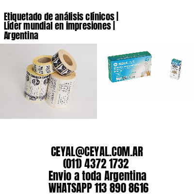 Etiquetado de análisis clínicos | Líder mundial en impresiones | Argentina