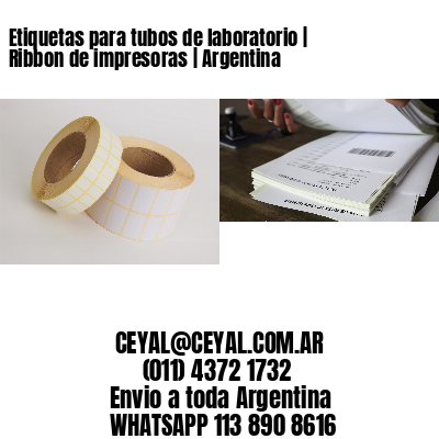 Etiquetas para tubos de laboratorio | Ribbon de impresoras | Argentina